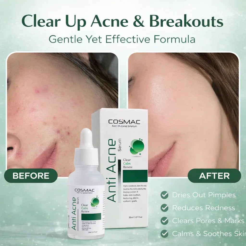 Anti Acne Serum - Cosmac