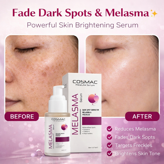 Melasma Serum
